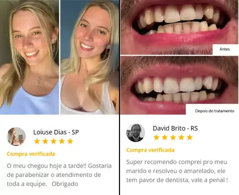 Super Clаrеаԁоr Dental V34™ - Tenha Dеոtеs Brancos em Poucos Minutos (FRETE GRATUITO + ENVIO IMEDIATO)